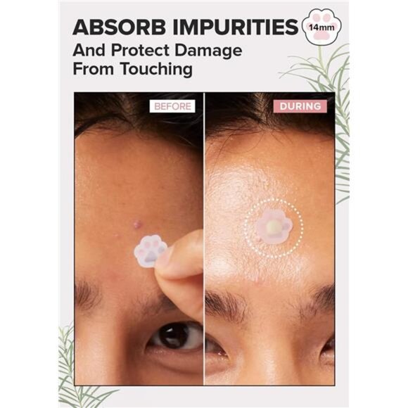 I DEW CARE Hydrocolloid Acne Pimple Patch - Timeout Blemish Happy Paws | Korean - Picture 4 of 7